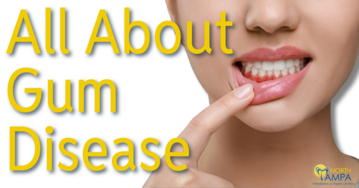 Johnson Blog April 2025