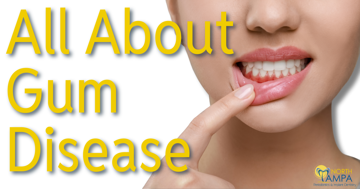 Johnson Blog April 2025