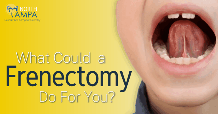 Johnson Blog July 2025